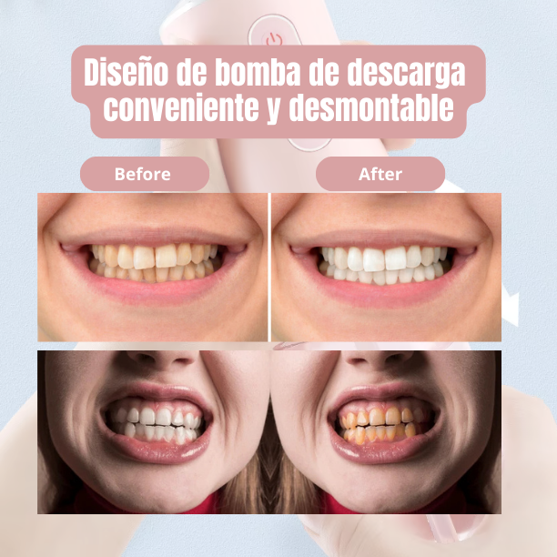 PulsoDental : Irrigador bucal inalámbrico de alta presión